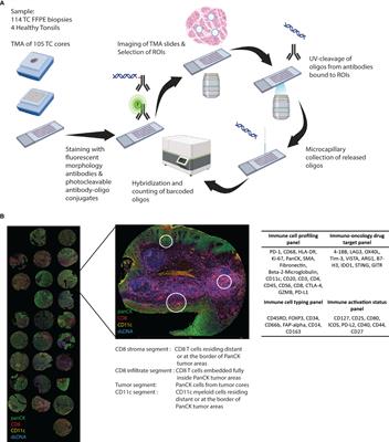 Targeted spatial proteomic analysis of CD8+ T- and myeloid cells in tonsillar cancer